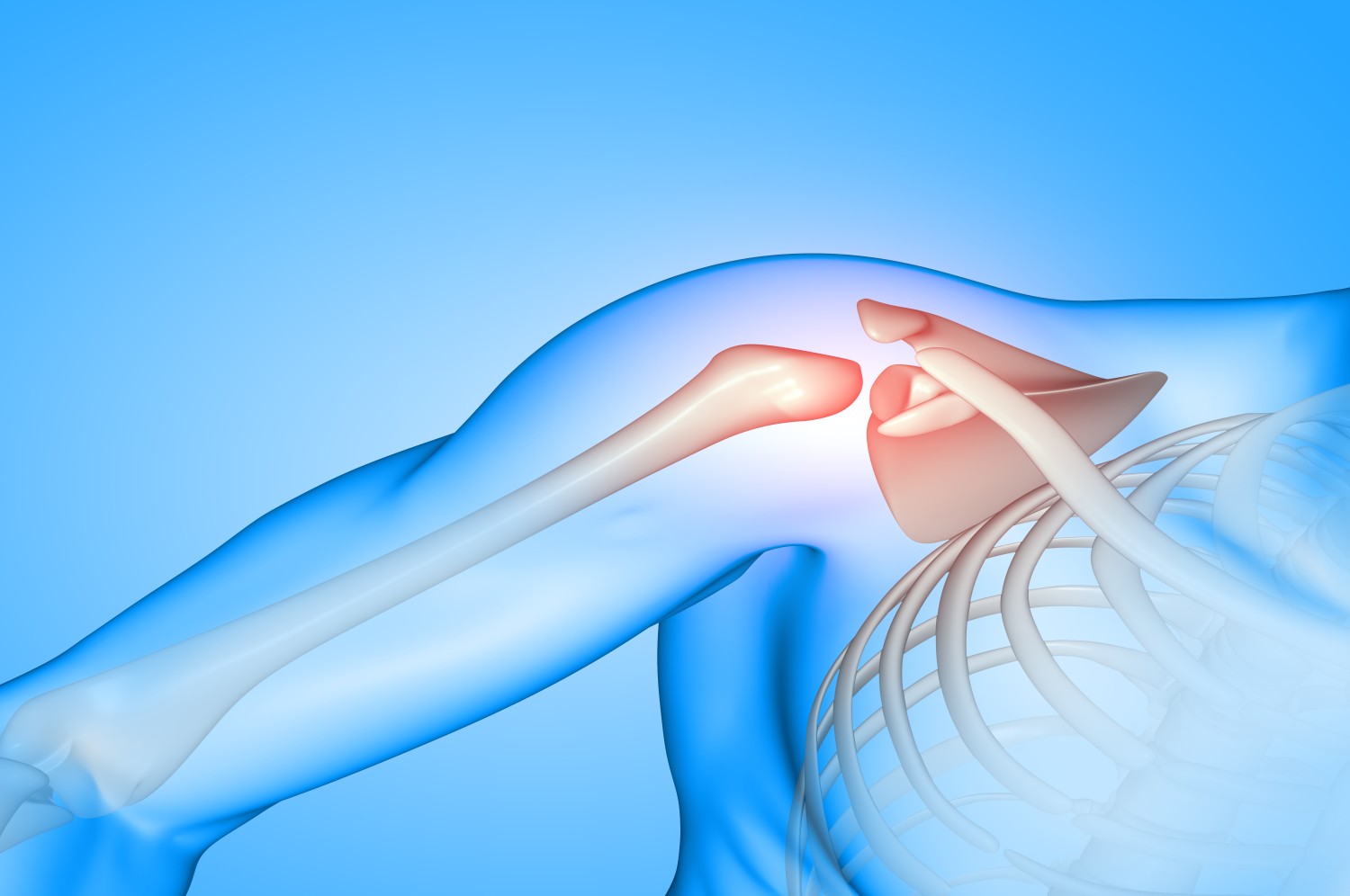 shoulder replacement surgery​ 