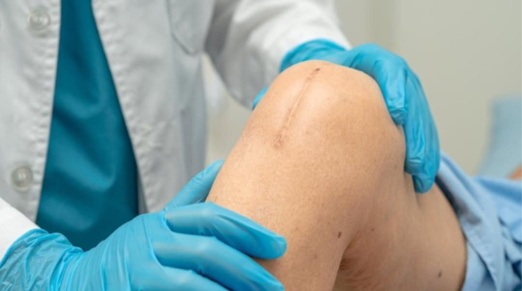 Experienced Knee Replacement Surgeon in Kerala