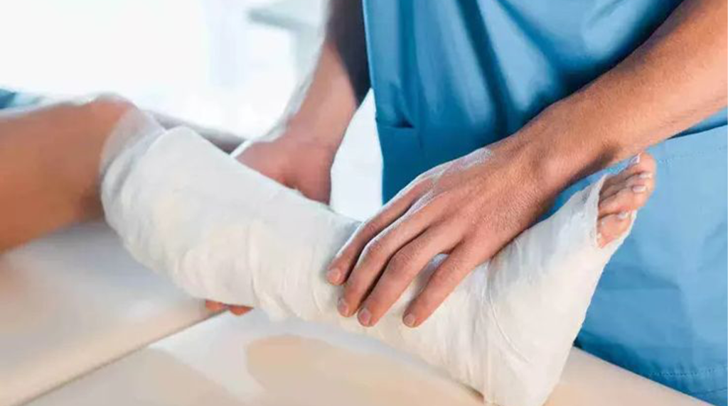 Bone fracture