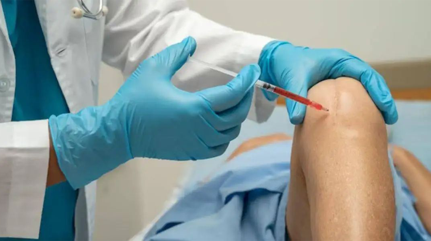 Runners knee causes treatment guide
